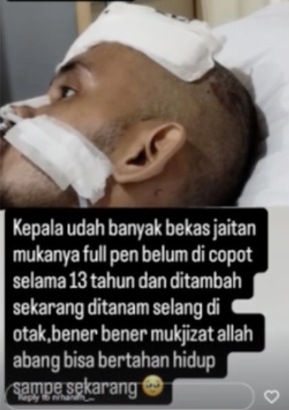 Kondisi Adnan korban tabrak Nadya Almira 